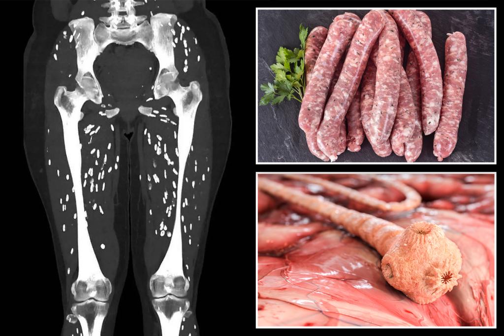 The terrifying scan shows the devastating effects of undercooked pork on the body